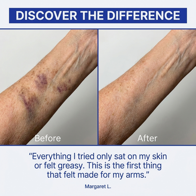 Stop Hiding Your Arms. Clear "Purple Spots" &amp; Thicken Paper-Thin Skin in 7 Days.