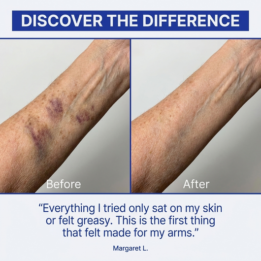 Stop Hiding Your Arms. Clear "Purple Spots" &amp; Thicken Paper-Thin Skin in 7 Days.
