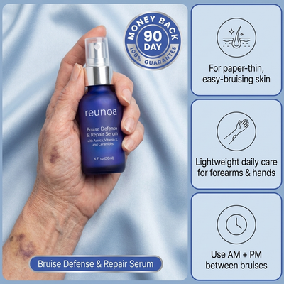 Stop Hiding Your Arms. Clear "Purple Spots" &amp; Thicken Paper-Thin Skin in 7 Days.